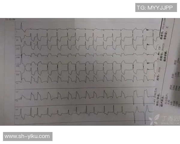 病毒性心肌炎影响足球球员生涯的案例分析与防治策略探讨